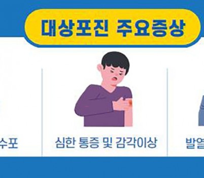 중원구보건소-성남시 대상포진 주요증상 안내 이미지.jpg width: 100%; height : 150px